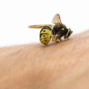 Dalla pollinosi alle punture di vespa tutte le allergie dell'estate